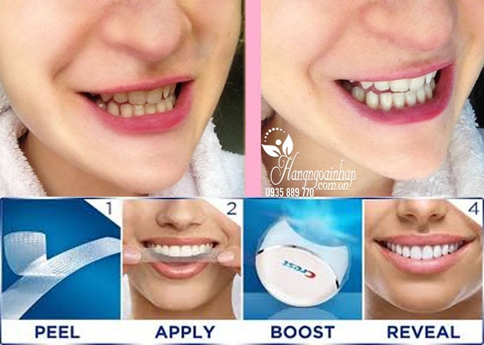 bo-san-pham-tay-trang-rang-crest-3d-white-no-slip-whitestrips-with-light-1-min Máy làm trắng răng Crest 3D White No Slip Whitestrips