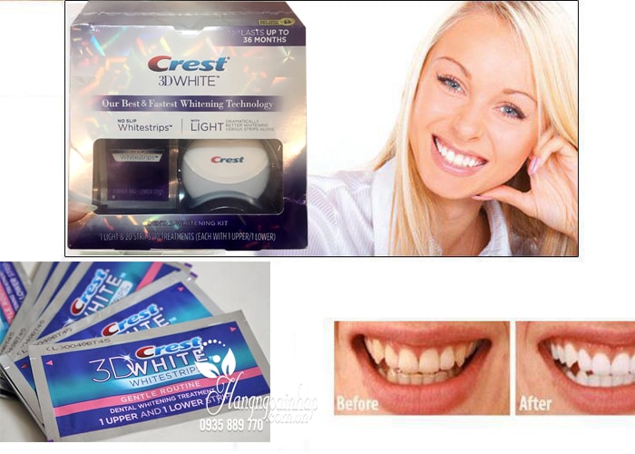 bo-san-pham-tay-trang-rang-crest-3d-white-no-slip-whitestrips-with-light-3-min Bộ sản phẩm tẩy trắng răng Crest 3D White No Slip Whitestrips With Light