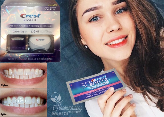 bo-san-pham-tay-trang-rang-crest-3d-white-no-slip-whitestrips-with-light-4-min Bộ sản phẩm tẩy trắng răng hiệu quả Crest 3D White No Slip Whitestrips With Light