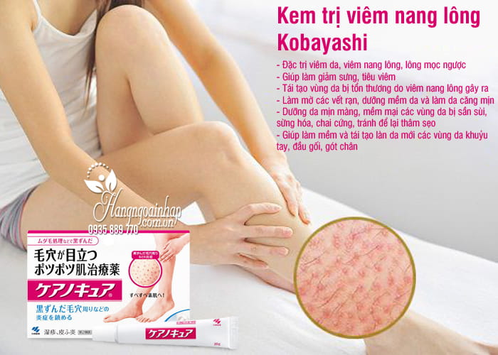 kem-tri-viem-nang-long-kobayashi-30g-cua-nhat-ban-12